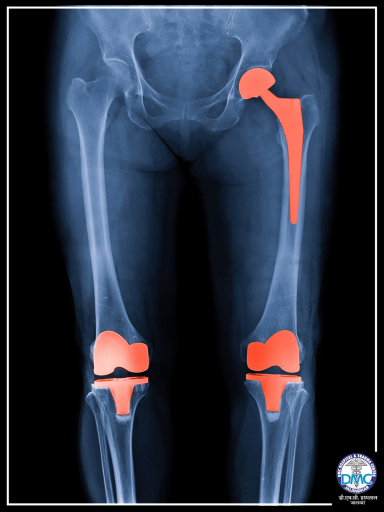 orthopaedic doctor in jalandhar